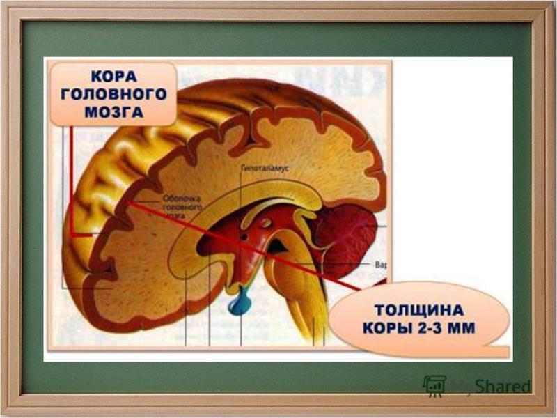 Восстановление коры мозга. Толщина коры головного мозга. Нет коры головного мозга.